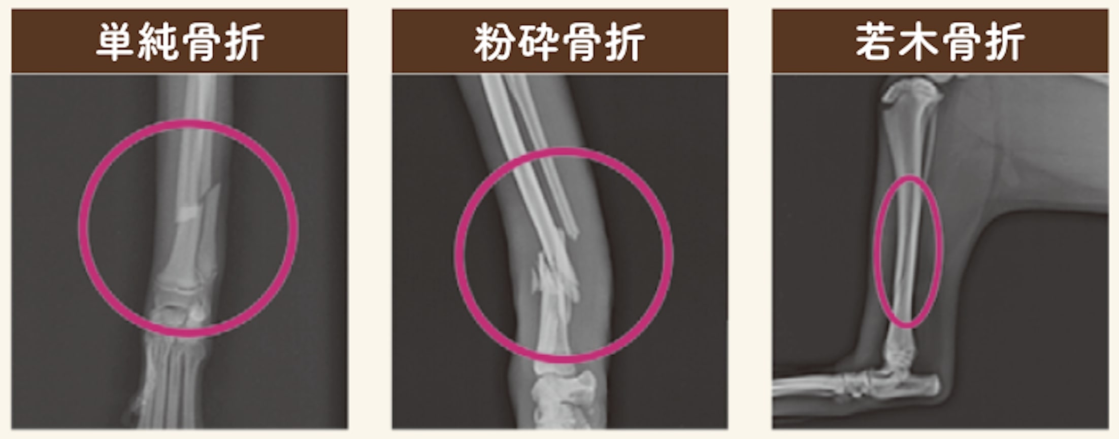折れ方によって幾つか種類があります。